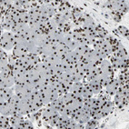 Anti-SRSF11 Antibody