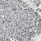 Immunohistochemical staining of human pancreas shows moderate to strong nuclear positivity in exocrine glandular cells.