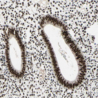 Immunohistochemical staining of human endometrium shows moderate to strong nuclear positivity in glandular cells.