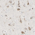 Immunohistochemical staining of human cerebral cortex shows moderate granular cytoplasmic positivity in neurons.