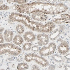 Immunohistochemical staining of human kidney shows moderate granular cytoplasmic positivity in cells in tubules.