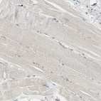 Immunohistochemical staining of human skeletal muscle shows very weak cytoplasmic positivity in striated muscle fibers.