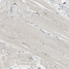 Immunohistochemical staining of human skeletal muscle shows very weak cytoplasmic positivity in striated muscle fibers.