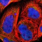 Immunofluorescent staining of human cell line A-431 shows localization to endoplasmic reticulum & lysosomes.