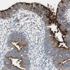 Immunohistochemical staining of human endometrium shows strong positivity in apical membrane in glandular cells.