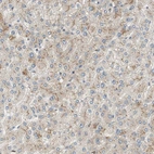 Immunohistochemical staining of human liver shows moderate membranous positivity in hepatocytes.