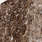 Immunohistochemical staining of human adrenal gland shows strong membranous positivity in glandular cells.