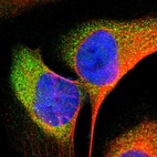 Immunofluorescent staining of human cell line U-2 OS shows localization to cytosol.