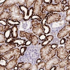 Anti-CA12 Antibody