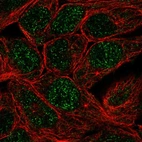 Immunofluorescent staining of human cell line RT4 shows localization to nucleus.