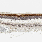 Immunohistochemical staining of human retina shows strong cytoplasmic positivity in rodes and cones cells.