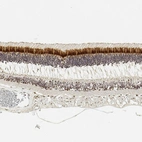 Immunohistochemical staining of human retina shows strong cytoplasmic positivity in rodes and cones cells.