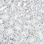 Immunohistochemical staining of human kidney shows mainly negative staining in cells in tubules.