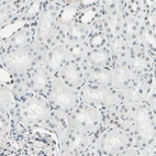 Immunohistochemical staining of human kidney shows mainly negative staining in cells in tubules.