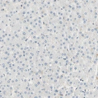 Immunohistochemical staining of human liver shows no positivity in hepatocytes as expected.