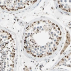 Immunohistochemical staining of human testis shows strong nuclear and cytoplasmic positivity in cells in seminiferous ducts.