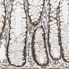 Immunohistochemical staining of human rectum shows moderate to strong nuclear positivity in glandular cells.