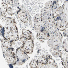 Immunohistochemical staining of human placenta shows moderate to strong nuclear positivity in trophoblastic cells.