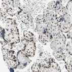 Immunohistochemical staining of human placenta shows moderate to strong nuclear positivity in trophoblastic cells.