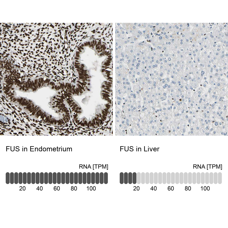 Anti-FUS Antibody