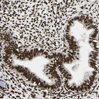 Immunohistochemical staining of human endometrium shows strong nuclear positivity in glandular cells.