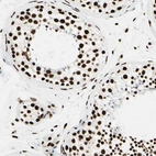 Immunohistochemical staining of human testis shows strong nuclear positivity in cells in seminiferous ducts.