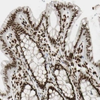 Immunohistochemical staining of human colon shows strong nuclear positivity in glandular cells.