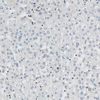 Immunohistochemical staining of human liver shows no positivity in hepatocytes as expected.