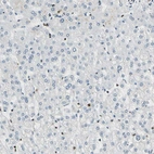 Immunohistochemical staining of human liver shows no positivity in hepatocytes as expected.
