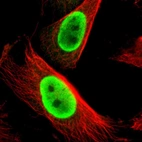 Immunofluorescent staining of human cell line U-251 MG shows localization to nucleoplasm.