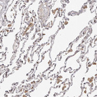 Immunohistochemical staining of human lung shows moderate nuclear positivity in a subset of pneumocytes.