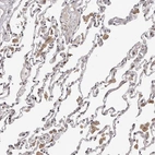 Immunohistochemical staining of human lung shows moderate nuclear positivity in a subset of pneumocytes.