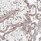Immunohistochemical staining of human placenta shows moderate nuclear positivity in Hofbauer cells, as well as weaker positivity in trophoblastic cells.