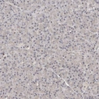 Immunohistochemical staining of human pancreas shows no positivity in exocrine glandular cells as expected.