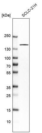 Anti-TP53BP1 Antibody