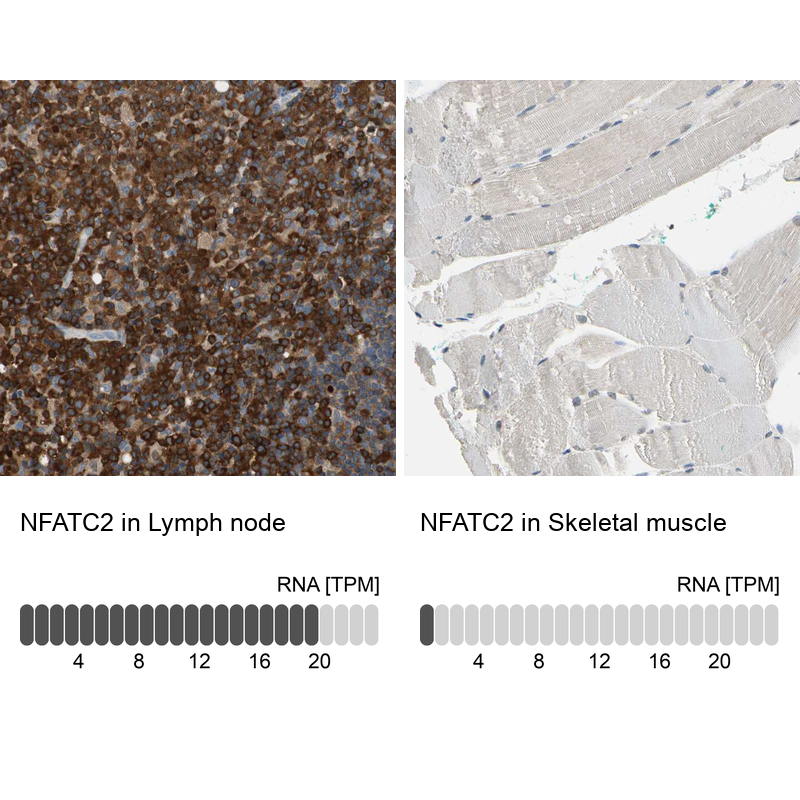 Anti-NFATC2 Antibody