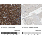 Anti-NFATC2 Antibody