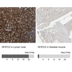 Anti-NFATC2 Antibody