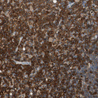 Immunohistochemical staining of human lymph node shows positivity in lymphoid cells.