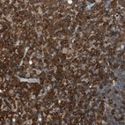 Immunohistochemical staining of human lymph node shows positivity in lymphoid cells.