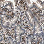 Immunohistochemical staining of human duodenum shows positivity in lymphoid cells.