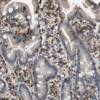 Immunohistochemical staining of human duodenum shows positivity in lymphoid cells.