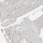 Immunohistochemical staining of human skeletal muscle shows no positivity in myocytes as expected.