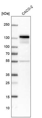 Western blot analysis in human cell line CACO-2.