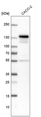 Western blot analysis in human cell line CACO-2.