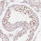 Anti-MYBL1 Antibody