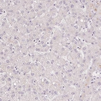 Immunohistochemical staining of human Liver shows no nuclear positivity in hepatocytes as expected.