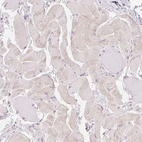 Immunohistochemical staining of human Skeletal muscle shows no nuclear positivity in myocytes as expected.