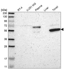 Western blot analysis in human cell line RT-4, human cell line U-251 MG, human plasma, human liver tissue and human tonsil tissue.