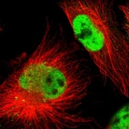 Immunofluorescent staining of human cell line U-251 MG shows localization to nucleoplasm.
